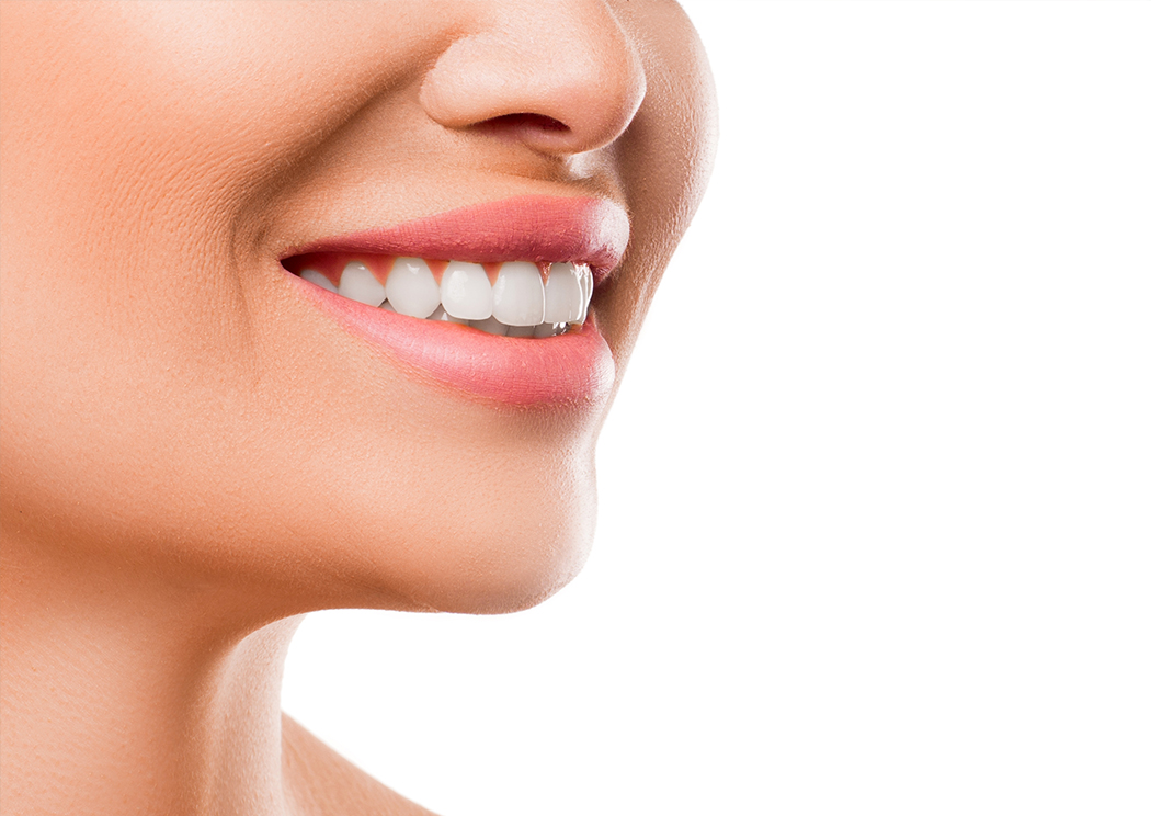 ホワイトニング